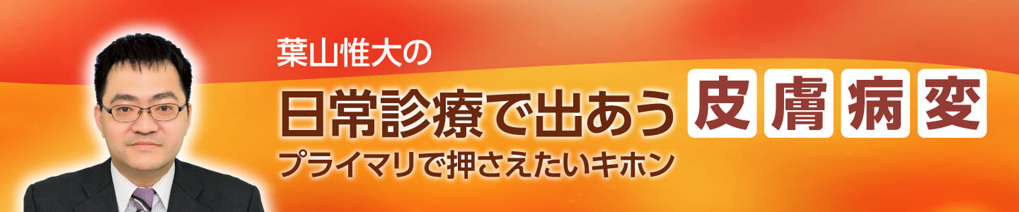 日常診療で出あう皮膚病変
