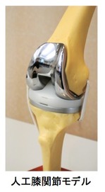 人工膝関節モデル