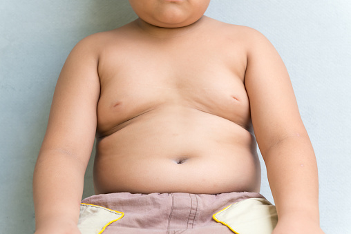 乳児期の感染症が小児肥満と関係か 医療ニュース Medical Tribune