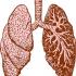 lungs-gcae9dafdc_肺の解剖図リサイズ.jpg